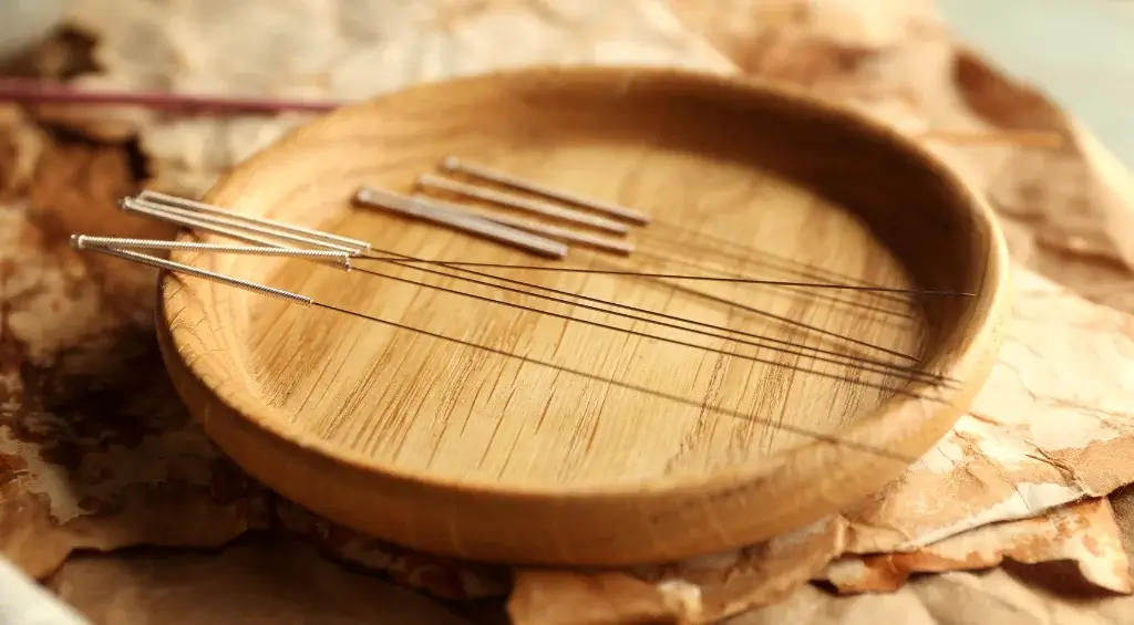 acupuntura
